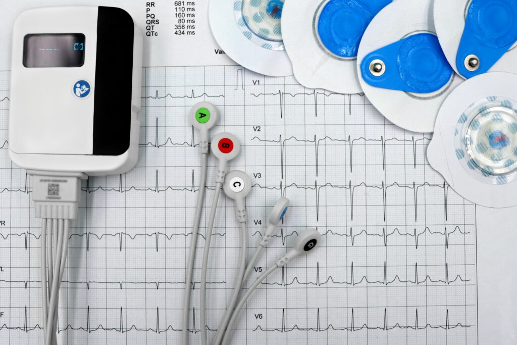 an EKG graph